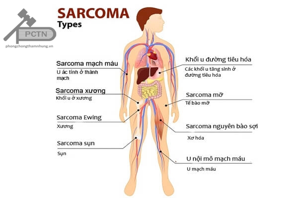 Các typ Sarcoma