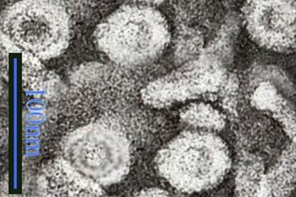 Chụp virus HBV bằng kính hiển vi điện tử quét