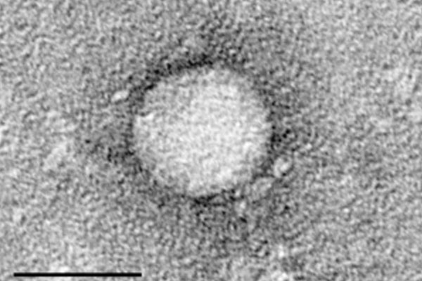Chụp virus HCV bằng kính hiển vi điện tử, tỉ lệ = 50 nm