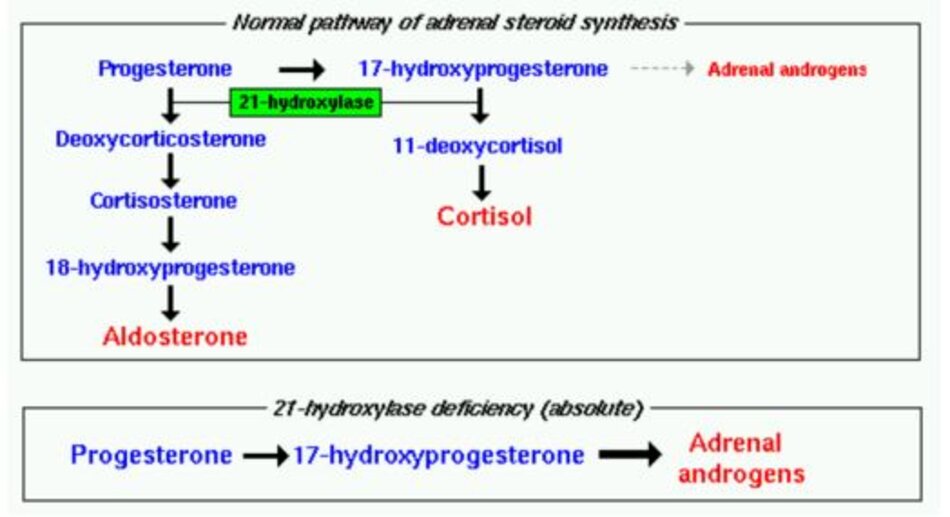 Hình 3: Trong CAH, có sự thiếu hụt tùy mức độ của 21-Hydroxylase, từ đây không tổng hợp được Aldosterone và Cortisol. Con đường tổng hợp dồn về Androgens, làm tăng 17-Hydroxyprogesterone.