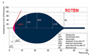 TEG and ROTEM: Cách tiếp cận đơn giản
