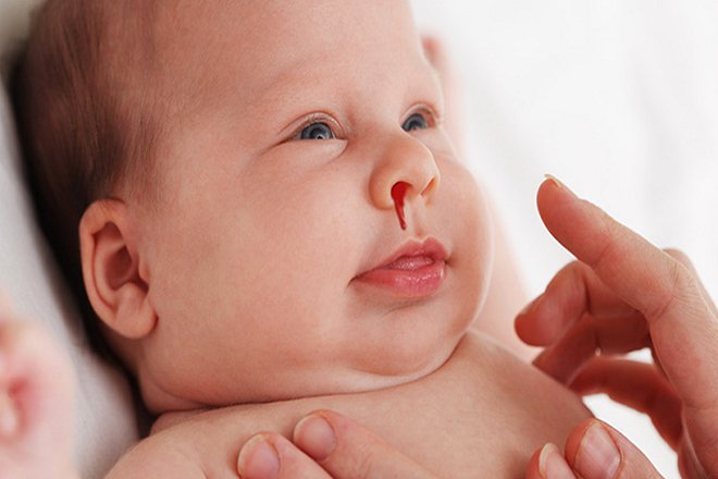 Khoảng tham chiếu đông máu ở trẻ sơ sinh
