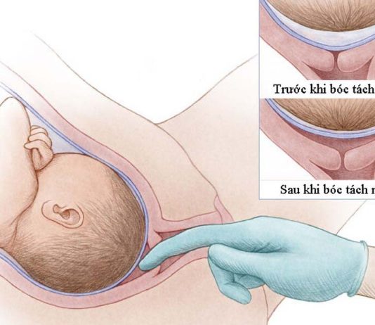 Thời điểm khởi phát chuyển dạ tối ưu sau ối vỡ non ở thai đủ thángThời điểm khởi phát chuyển dạ tối ưu sau ối vỡ non ở thai đủ tháng