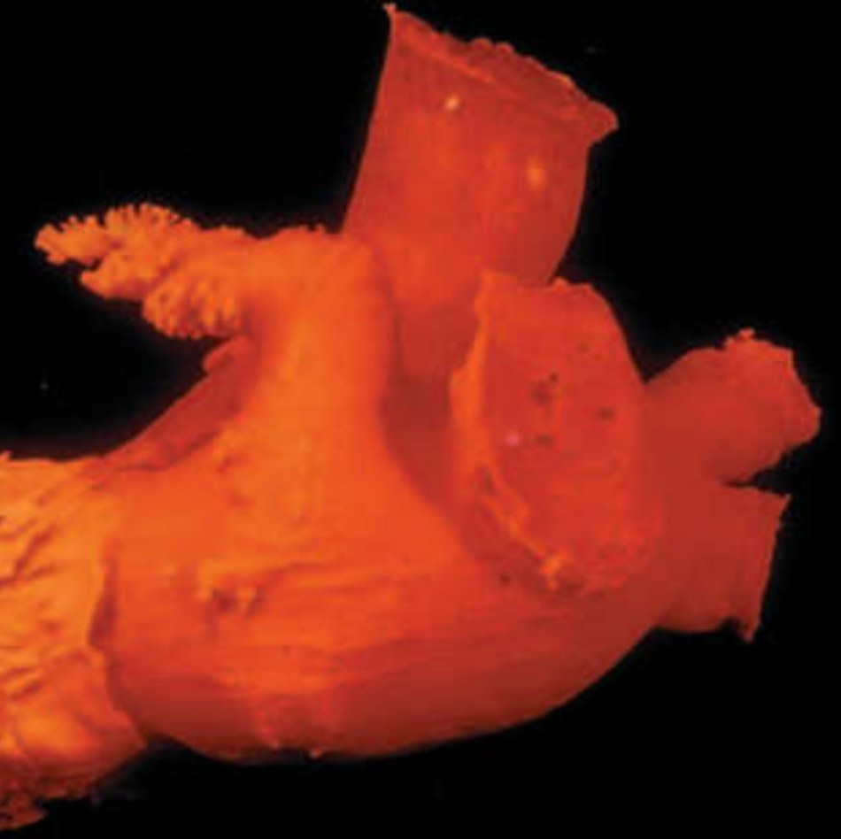 Hình 1 Trụ nội tâm mạc của tim trái cho thấy “ruột thừa” của nhĩ trái (tiểu nhĩ trái) có nhiều thớ cơ