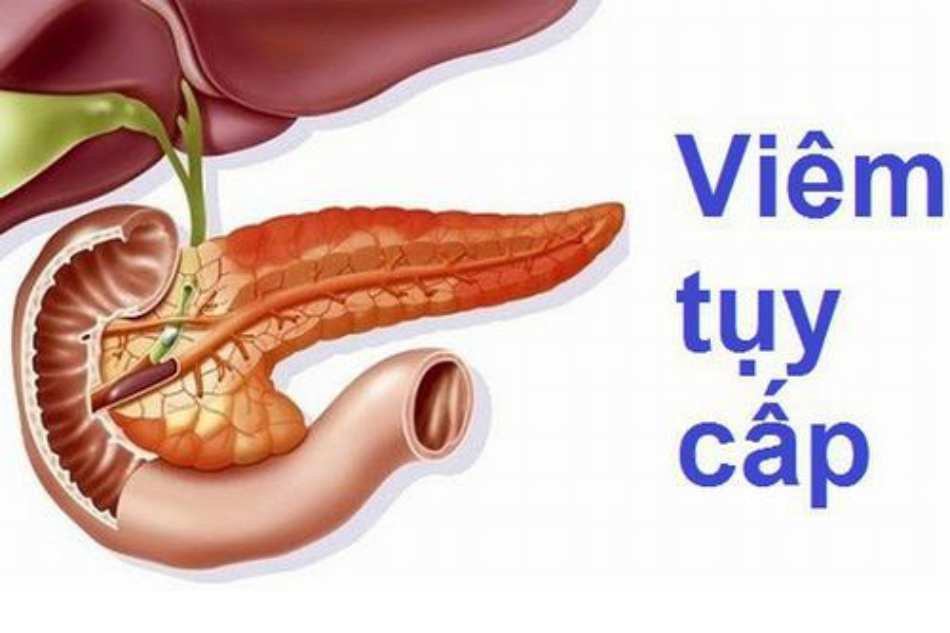 ĐIỀU TRỊ NỀN TẢNG BAN ĐẦU BỆNH NHÂN VIÊM TUỴ CẤP