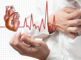Đồng thuận chuyên gia 2023 của ACC về điều trị suy tim phân suất tống máu bảo tồn 1