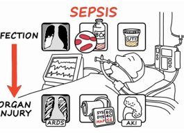 QUẢN LÝ TỤT HUYẾT ÁP Ở BỆNH NHÂN XƠ GAN VÀ SEPSIS