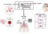 Cơ học hô hấp để hiểu ARDS và hướng dẫn thở máy