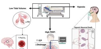 Cơ học hô hấp để hiểu ARDS và hướng dẫn thở máy